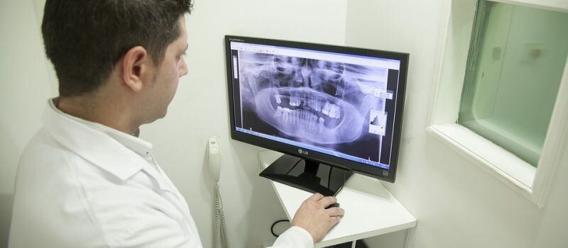 Replace your missing teeth with dental implants and watch your face transform